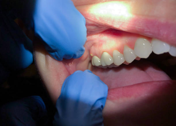 Best Emergency TMJ Treatment in Lockland, OH